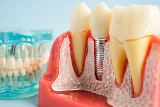 Best Root Canal Treatment  in Petersburg, VA